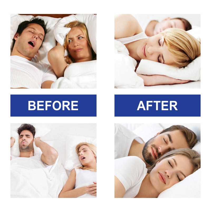 Sleep Stickers Relieve Mouth Breathing Anti-snoring Care Sleep